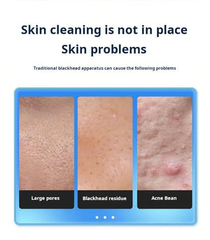 جهاز تنظيف البشرة الفقاعي بالماء والشفط  Water Bubble Facial Cleaner.